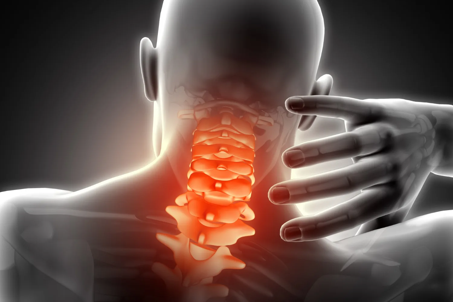 Cirugía cervical anterior en Guadalajara, Jalisco: Solución avanzada para patologías del cuello