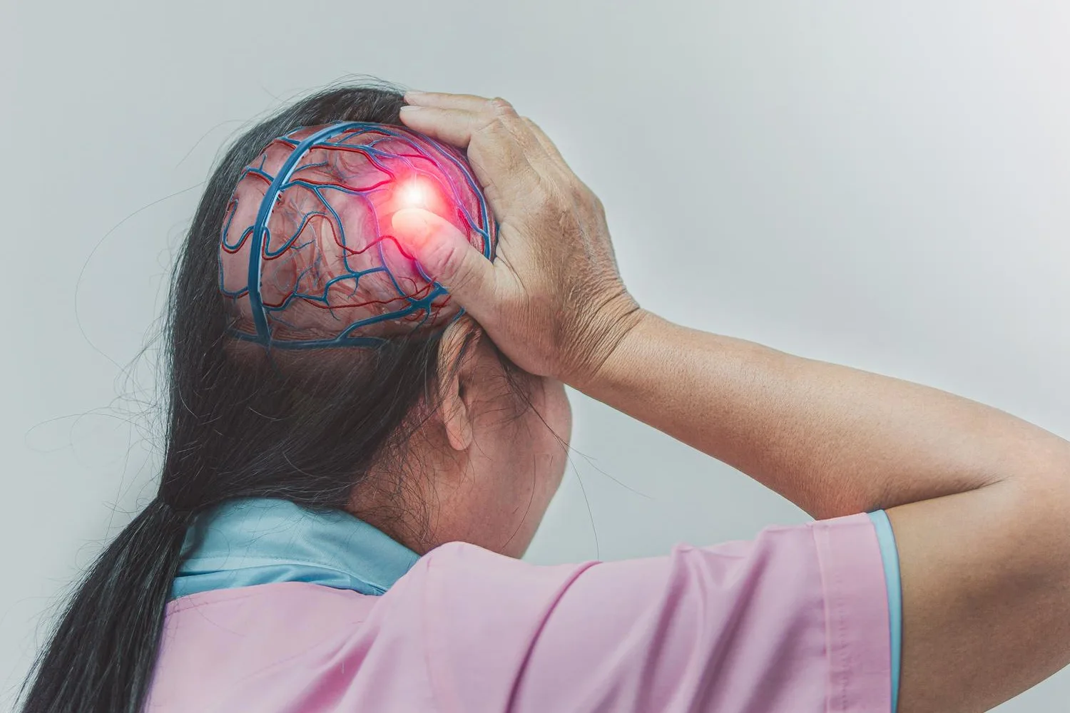 Hematoma subdural crónico en Guadalajara