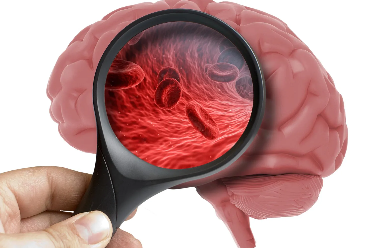 Tumores cerebrales en Guadalajara